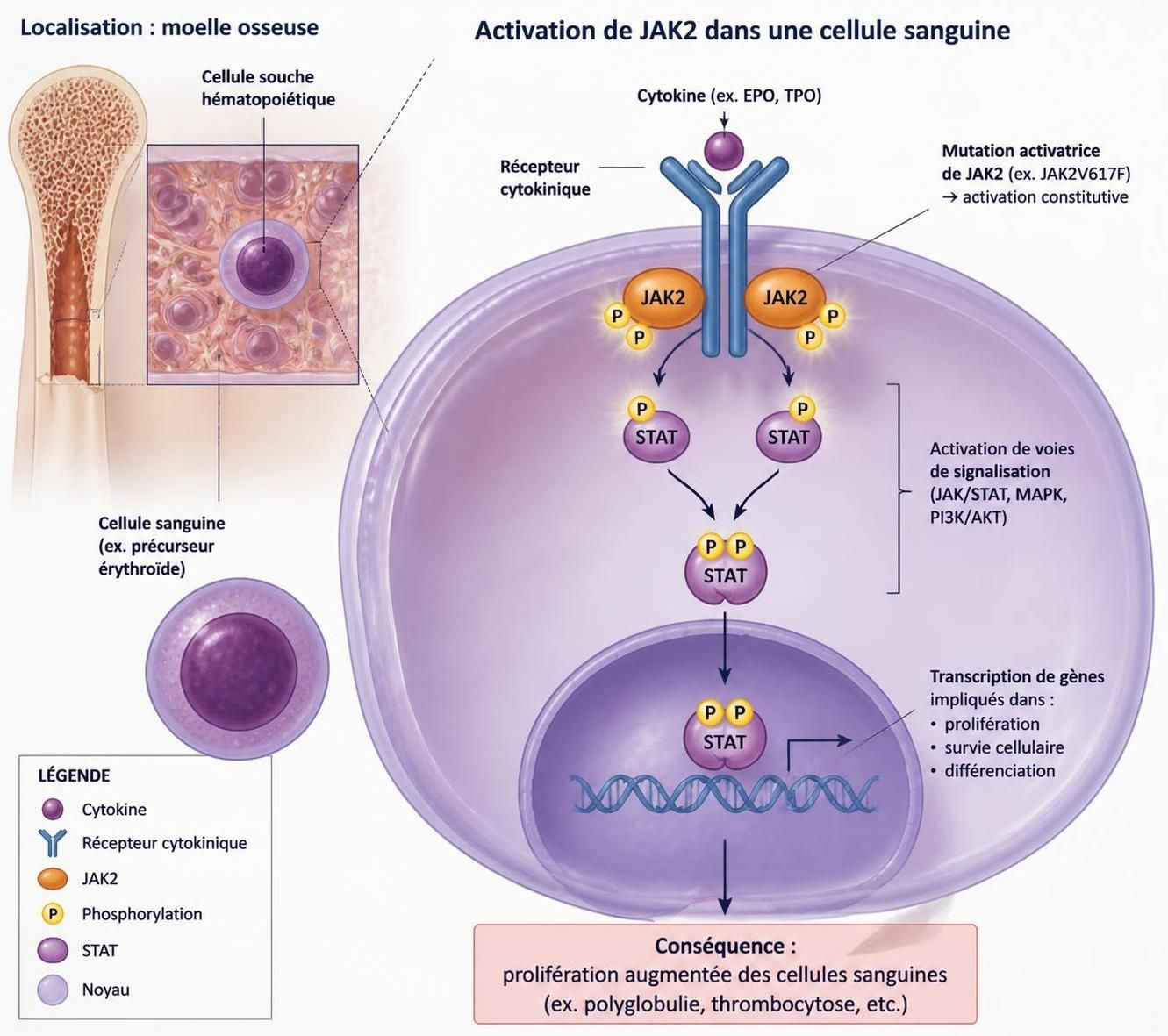 découvrez tout ce qu'il faut savoir sur la maladie de vaquez : symptômes, causes, diagnostic et options de traitement pour mieux comprendre et gérer cette maladie.